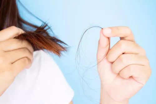 La chute de cheveux